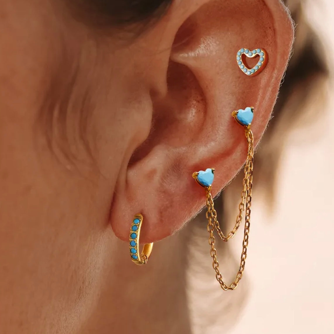 ARETES